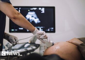 Better NHS care might have saved 58 babies, BBC finds
