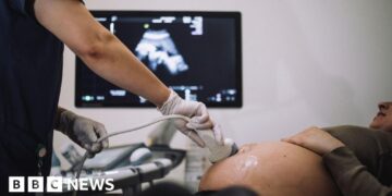 Better NHS care might have saved 58 babies, BBC finds