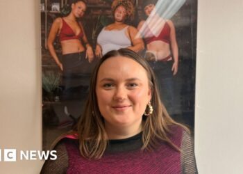 Breaking an ankle led to Manchester student's fashion career