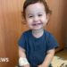 Lab-grown food pipe offers new hope for young patients