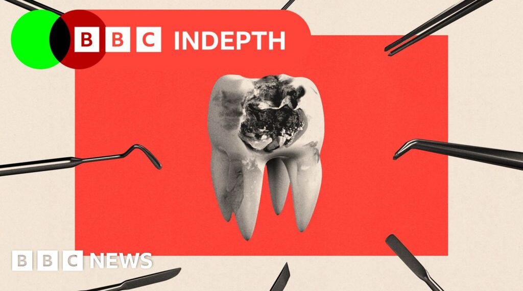 NHS dentistry is rotting. Will the plan to fix it work?