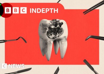 NHS dentistry is rotting. Will the plan to fix it work?