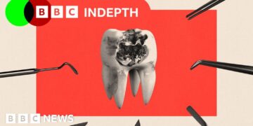 NHS dentistry is rotting. Will the plan to fix it work?