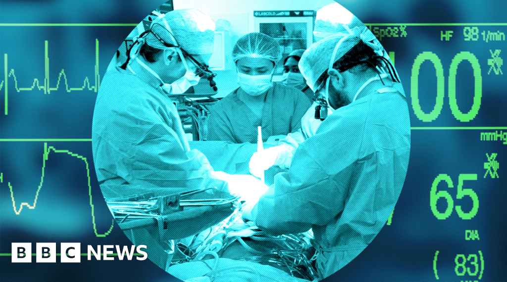 UK's transplant system was world-leading - now it lags behind other Western nations