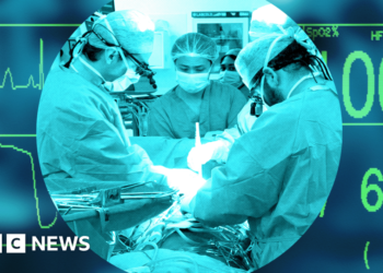 UK's transplant system was world-leading - now it lags behind other Western nations