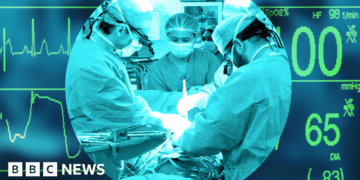 UK's transplant system was world-leading - now it lags behind other Western nations