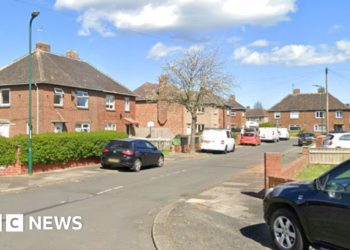 Child dies in dog attack, police say