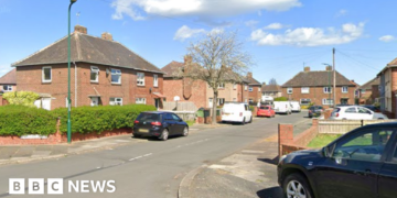 Child dies in dog attack, police say