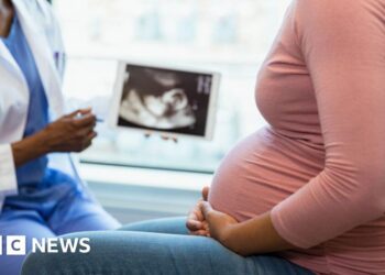 Early care scheme could prevent thousands of miscarriages a year