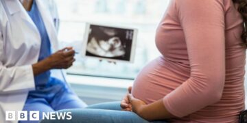 Early care scheme could prevent thousands of miscarriages a year