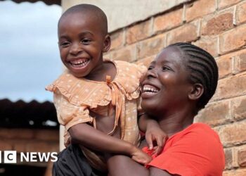 'I adore her now': Mother learns to cope with child's autism in a country with little help