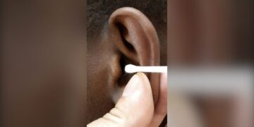Should we be using cotton buds to clean our ears?
