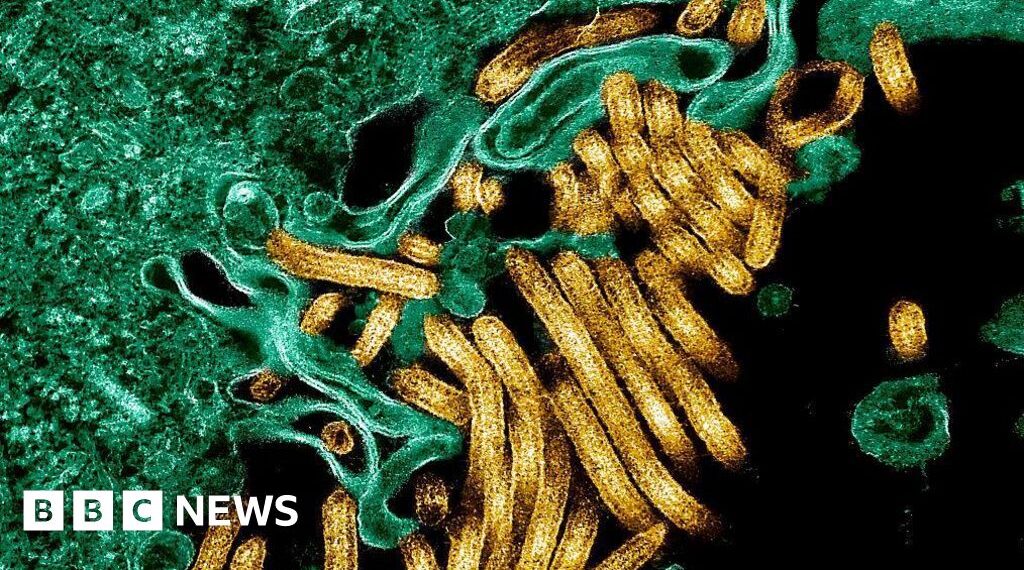 Ebola outbreak kills 65 in eastern DR Congo's Ituri province