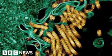Ebola outbreak kills 65 in eastern DR Congo's Ituri province