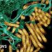 Ebola outbreak kills 65 in eastern DR Congo's Ituri province
