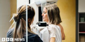 Millions of breast cancer patients could safely avoid chemotherapy, study suggests