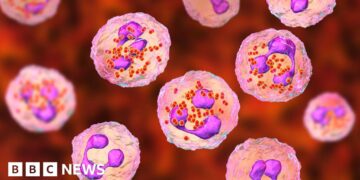 One dead and two ill after meningitis cases in Reading