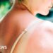 Riskiest skin cancer cases hit UK record high