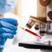 Brazil monitors two patients for possible Ebola infection