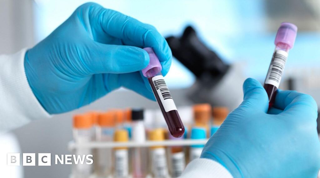 Two possible Ebola cases in Brazil ruled out as patients test negative