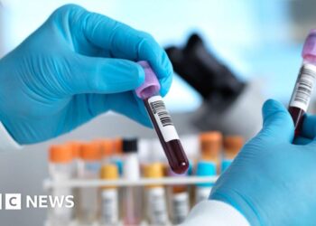 Two possible Ebola cases in Brazil ruled out as patients test negative