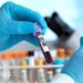 Two possible Ebola cases in Brazil ruled out as patients test negative